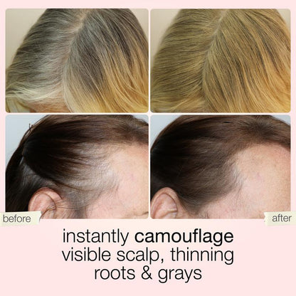 Instant Hairline Eraser-Say Goodbye to Thinning Hair & Gray Roots in 5 Seconds flat