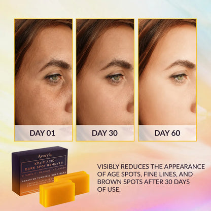 Kojic Acid Dark Spot Cleansing Bar