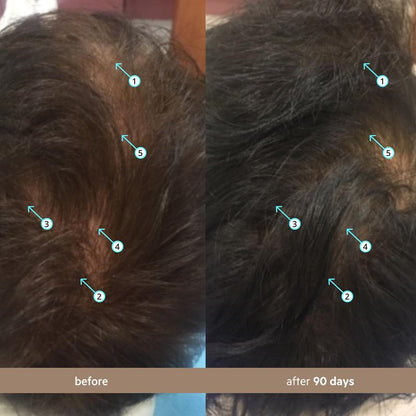 Avoryla Men's (Avoryla.DNC-N) | Hair Density Serum with 5% Hair Density Complex