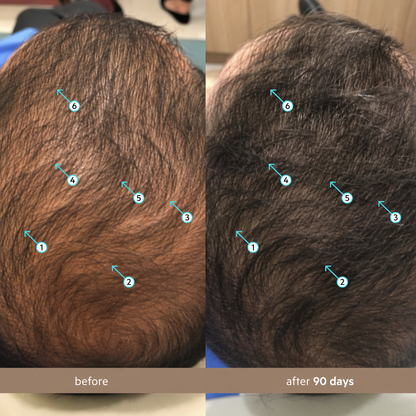 Avoryla Men's (Avoryla.DNC-N) | Hair Density Serum with 5% Hair Density Complex