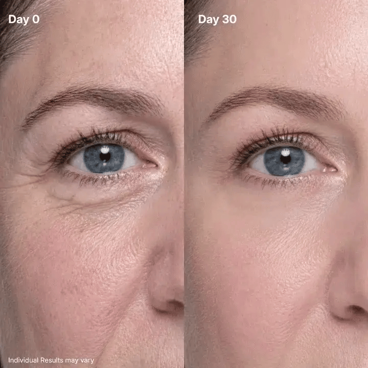 🔥Final 2 Hour 50% OFF🔥P7 Eye Renewal Crème