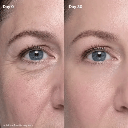 🔥Final 2 Hour 50% OFF🔥P7 Eye Renewal Crème